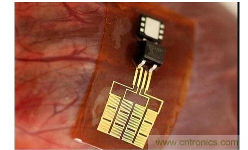 可將人體變成電腦的電子皮膚！