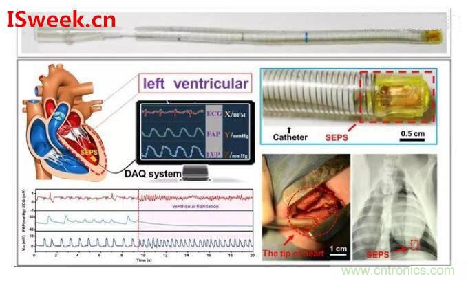 詳解光纖壓力傳感器在心內(nèi)壓評(píng)估的應(yīng)用 詳解光纖壓力傳感器在心內(nèi)壓評(píng)估的應(yīng)用