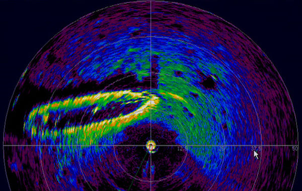 什么是激光雷達(dá)以及如何使用它？