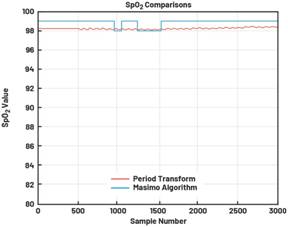 動態(tài)離散周期變換技術(shù)突破：無ECG參考的生理信號精準(zhǔn)解析